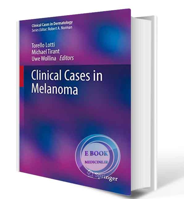 دانلود کتاب  Clinical Cases in Melanoma (Clinical Cases in Dermatology) 2020  (Original PDF)